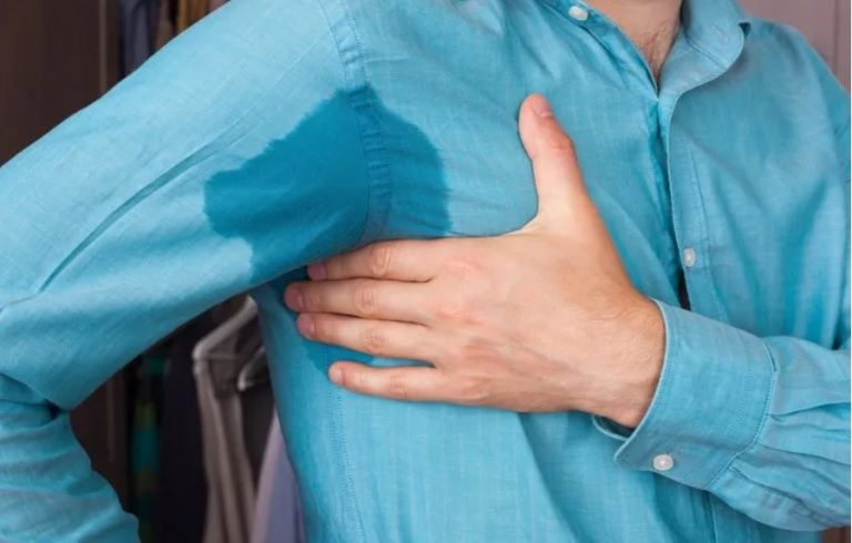 BOTOX FOR EXCESSIVE SWEATING