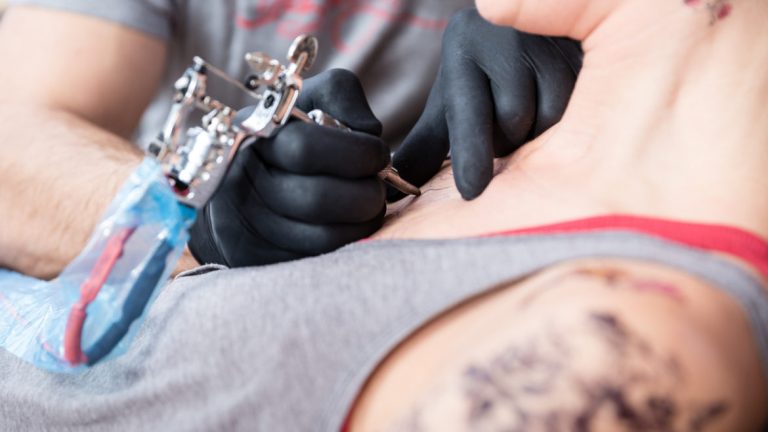 Um, What if You Want that Brand New Tattoo Removed?