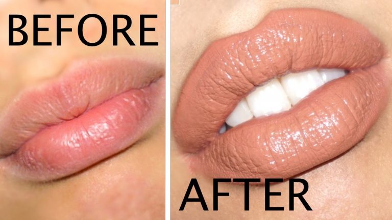 10 Lip Filler Tips Before You Go In