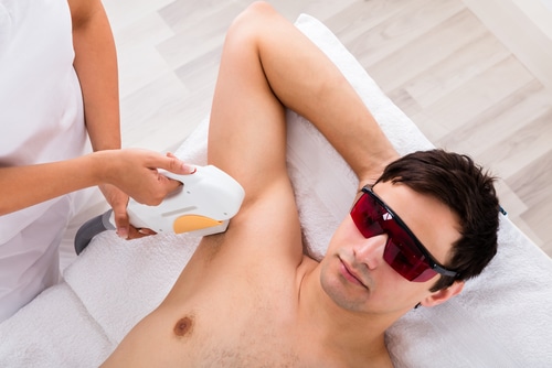 5 Compelling Reasons to Consider Laser Hair Removal